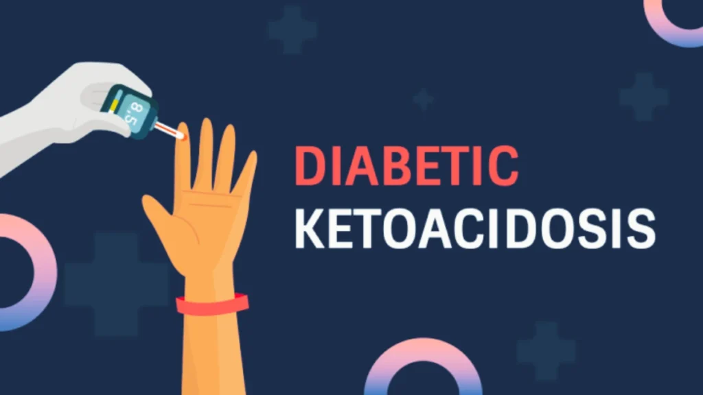 Diabetic Ketoacidosis Treatment PPT