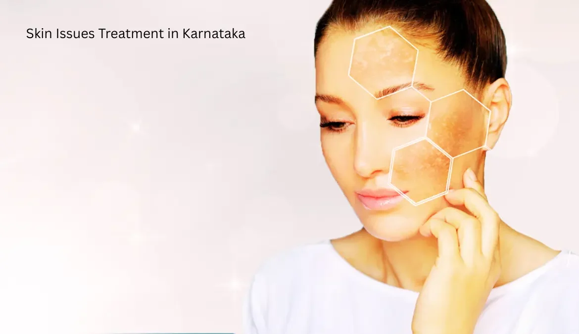 Skin Issues Treatment in Karnataka